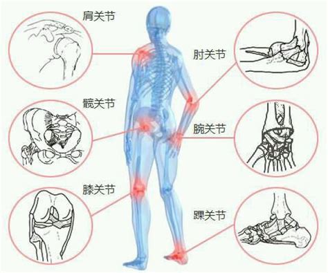 朱德湘|风湿与骨关节病治疗新突破